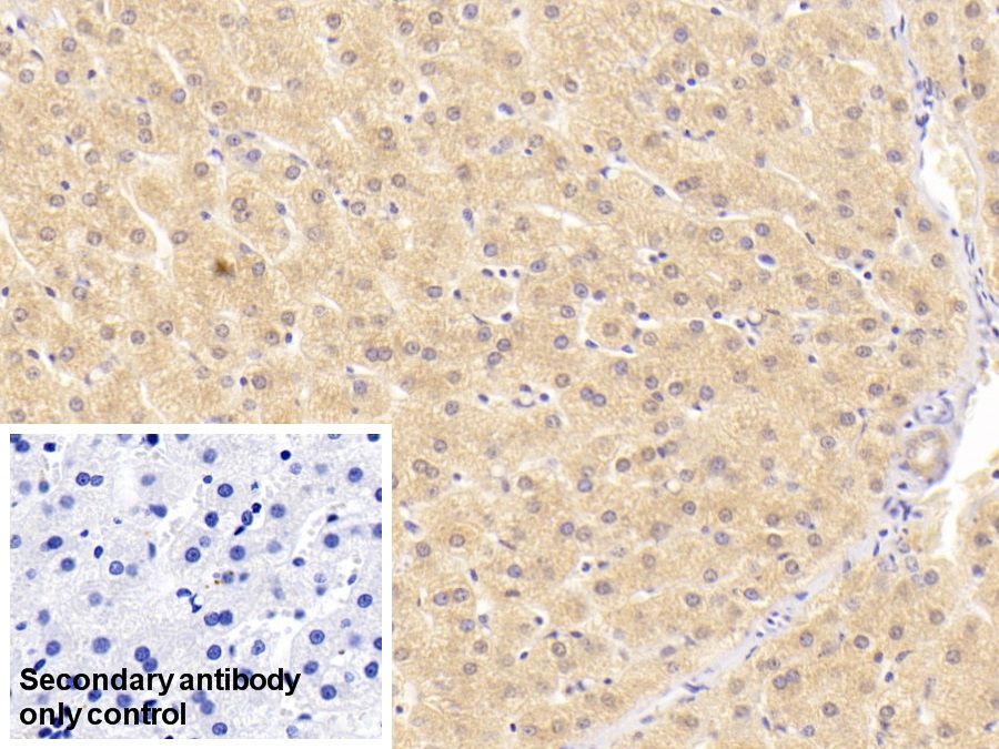 Monoclonal Antibody to Alanine Aminotransferase (ALT)