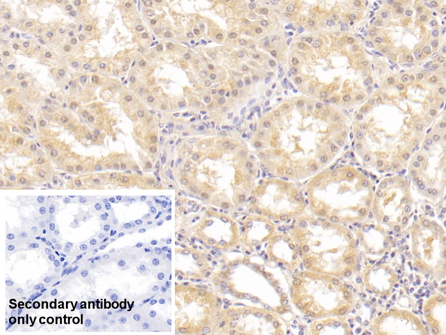 Monoclonal Antibody to Alanine Aminotransferase (ALT)