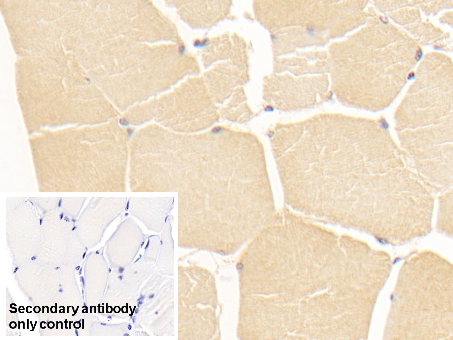 Monoclonal Antibody to Alanine Aminotransferase (ALT)