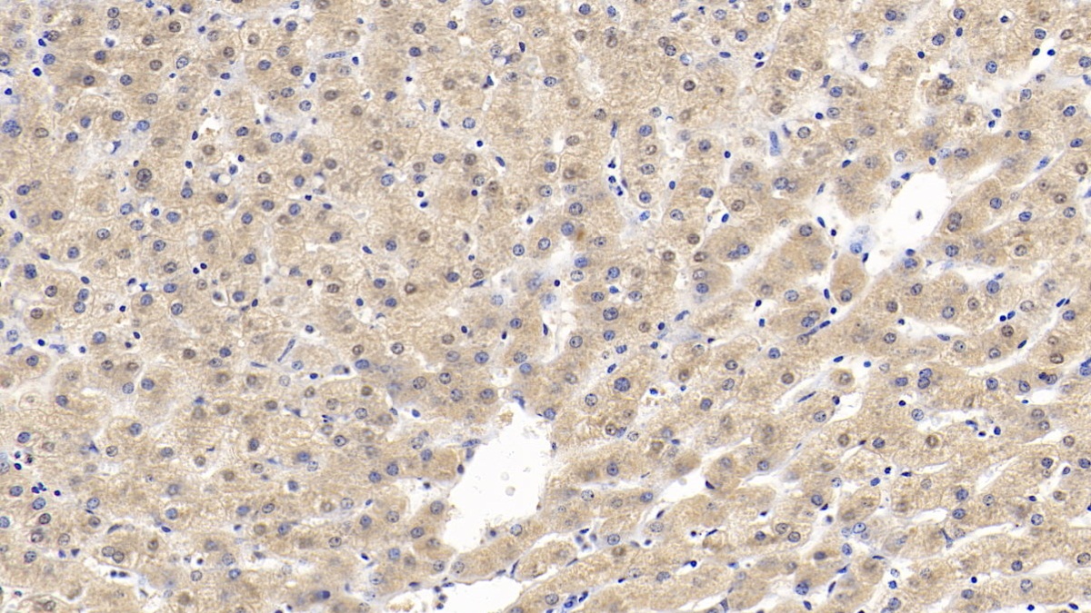 Monoclonal Antibody to Alanine Aminotransferase (ALT)