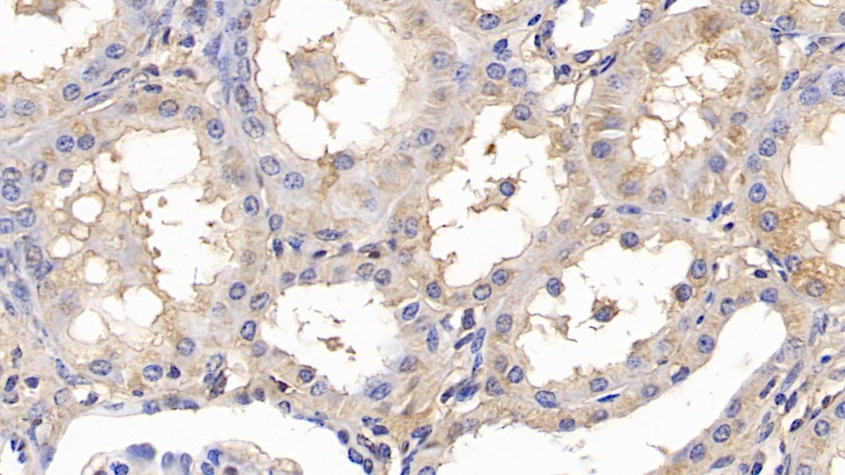 Monoclonal Antibody to Alanine Aminotransferase (ALT)