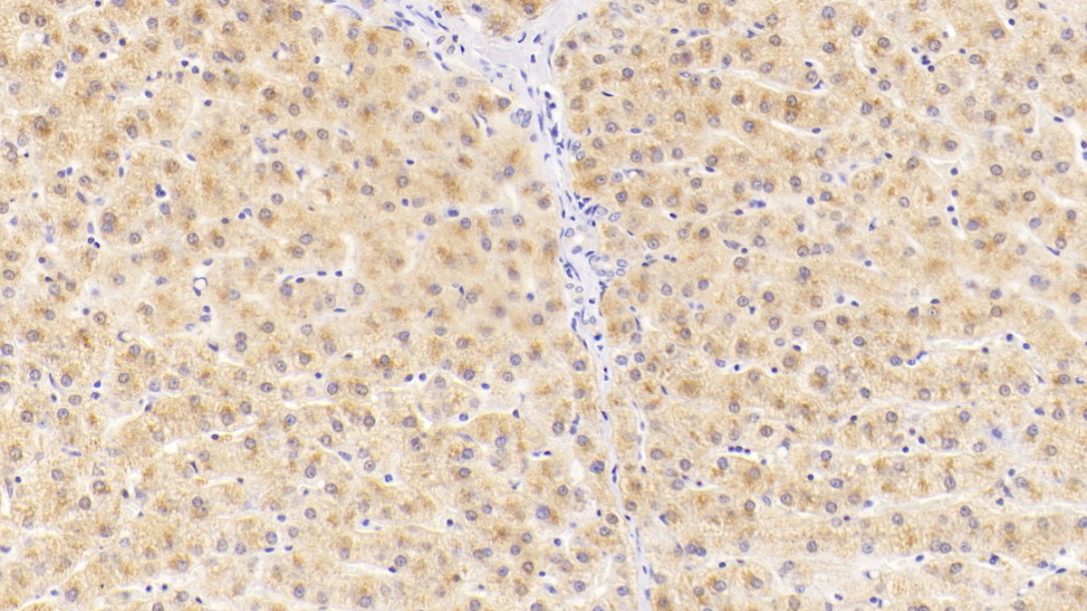 Monoclonal Antibody to Alanine Aminotransferase (ALT)