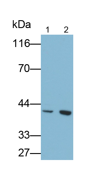 Monoclonal Antibody to Transforming Growth Factor Beta 2 (TGFb2)