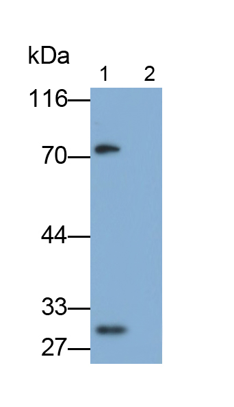 Monoclonal Antibody to Interferon Beta (IFNb)