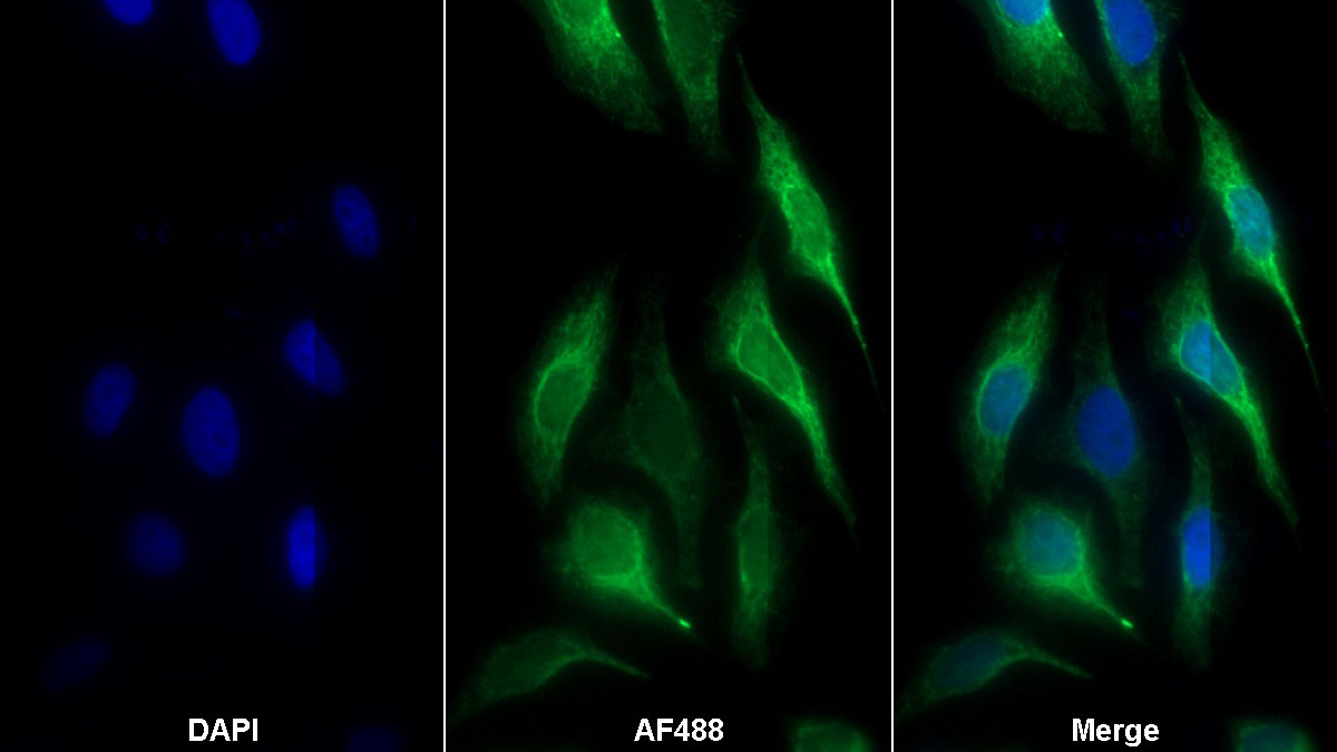 Monoclonal Antibody to Interferon Beta (IFNb)