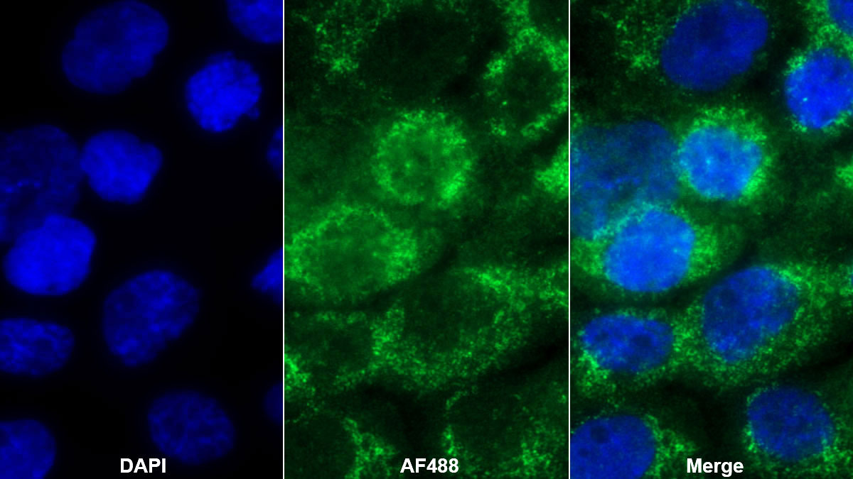 Monoclonal Antibody to Interleukin 1 Receptor Antagonist (IL1RA)