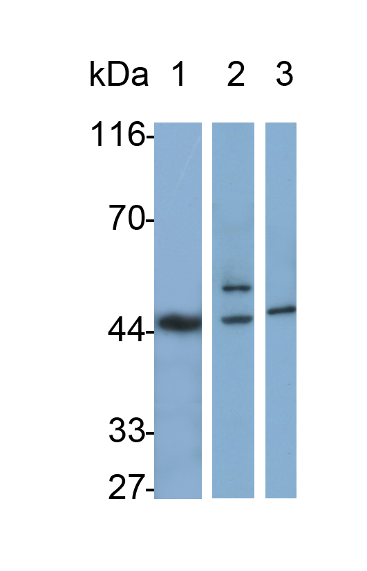 Monoclonal Antibody to Interleukin 1 Receptor Antagonist (IL1RA)