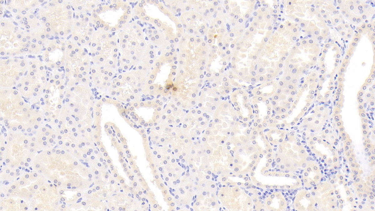 Monoclonal Antibody to Cyclophilin B (CYPB)