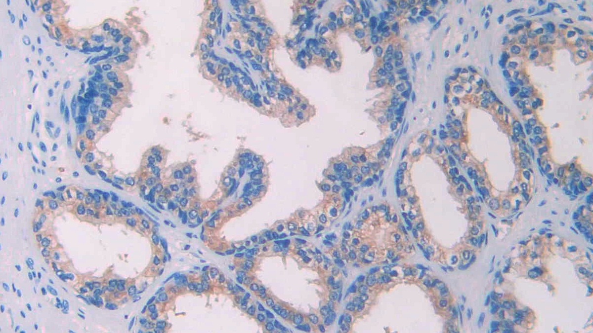 Monoclonal Antibody to Anti-Mullerian Hormone (AMH)