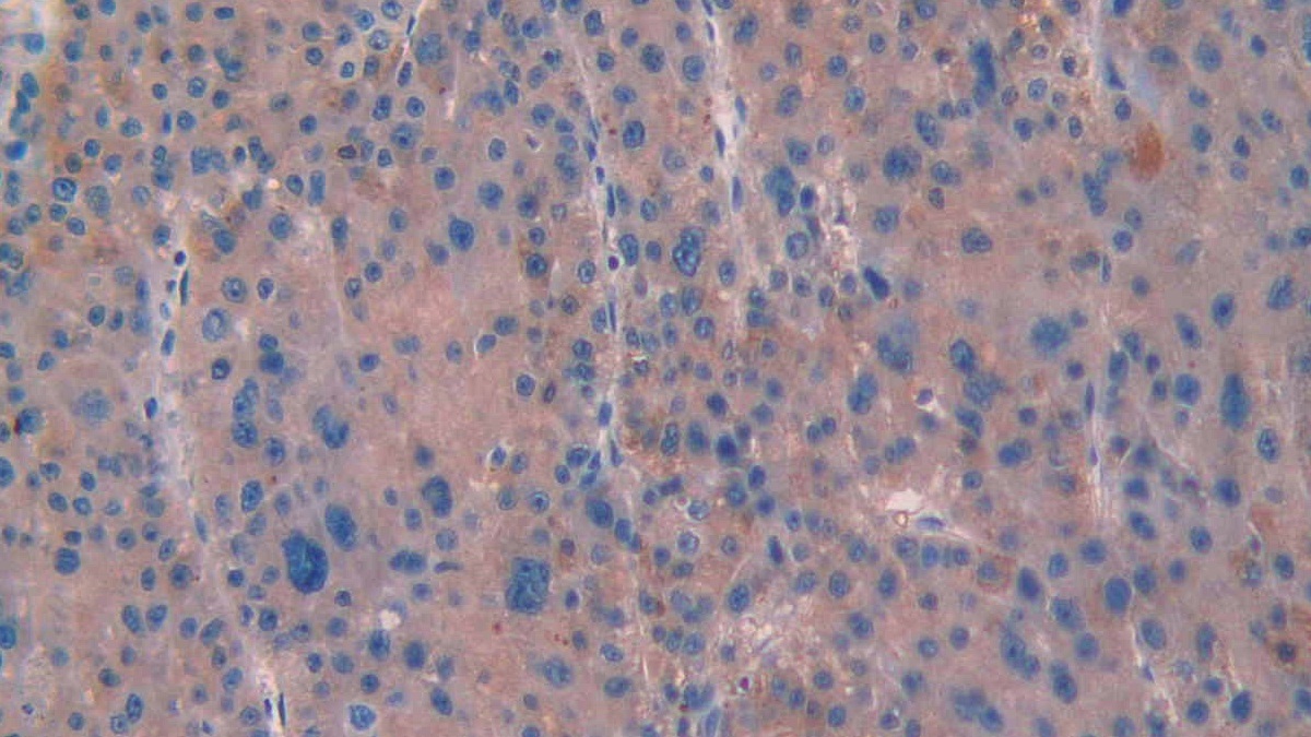 Monoclonal Antibody to Anti-Mullerian Hormone (AMH)