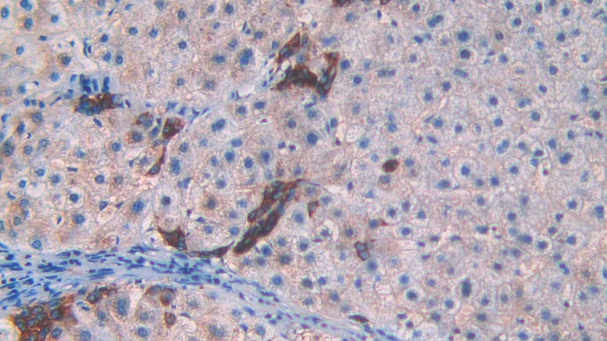 Monoclonal Antibody to Anti-Mullerian Hormone (AMH)