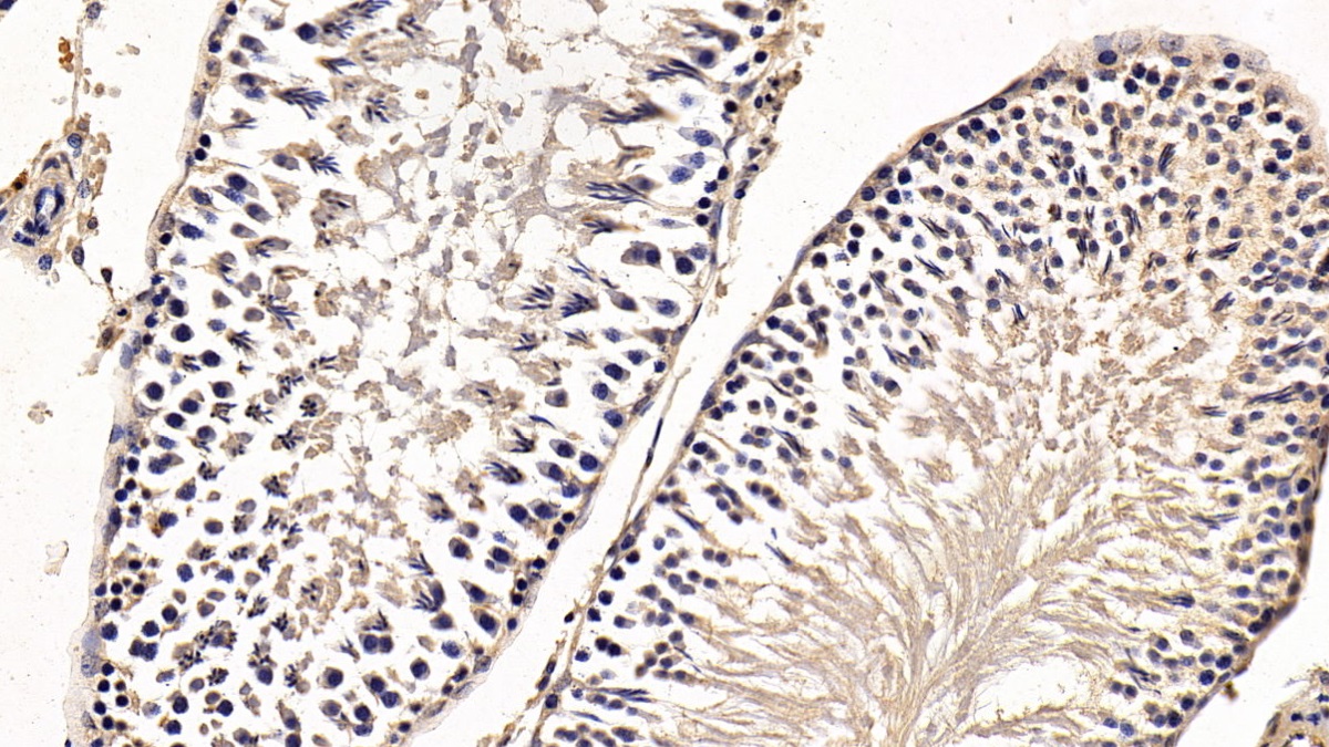 Monoclonal Antibody to Anti-Mullerian Hormone (AMH)