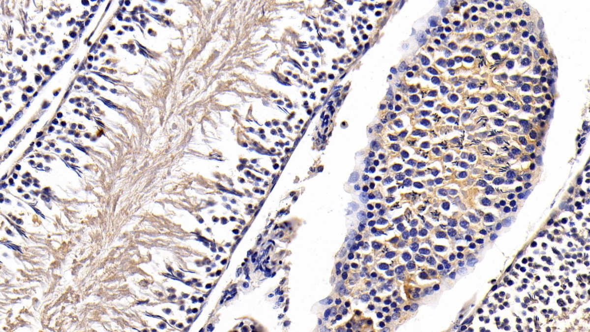 Monoclonal Antibody to Anti-Mullerian Hormone (AMH)