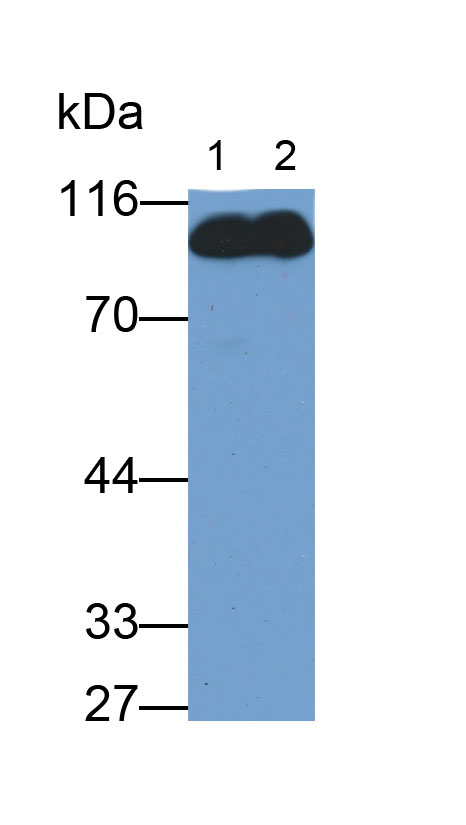 Monoclonal Antibody to Complement 1 Inhibitor (C1INH)