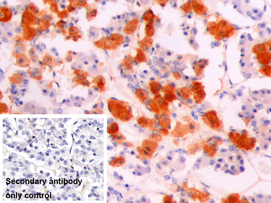 Monoclonal Antibody to Alpha-Melanocyte Stimulating Hormone (aMSH)