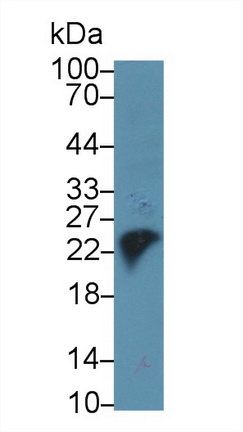 Monoclonal Antibody to Trypsin (TRY)