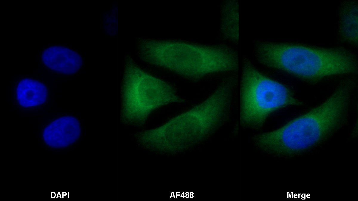 Monoclonal Antibody to Apolipoprotein C1 (APOC1)