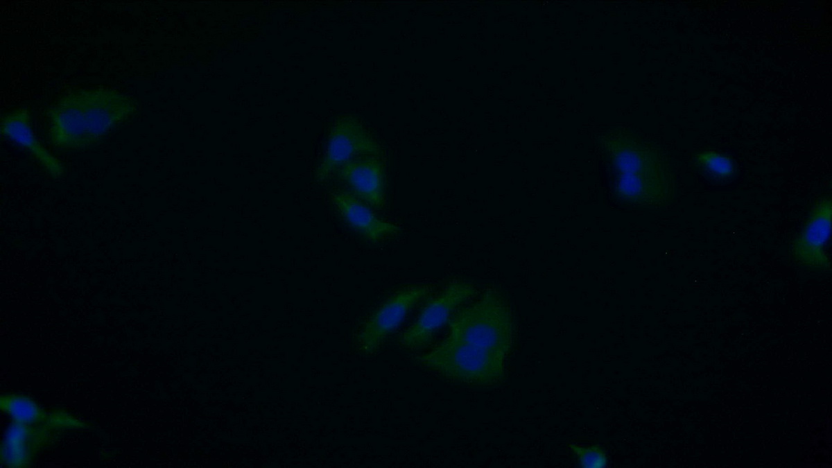 Monoclonal Antibody to Annexin V (ANXA5)