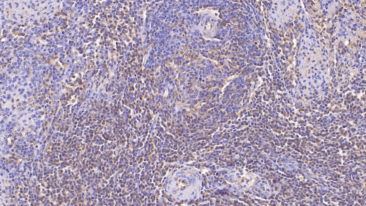 Monoclonal Antibody to Annexin V (ANXA5)