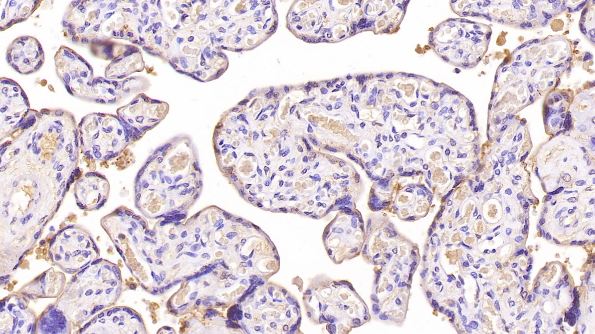 Monoclonal Antibody to Annexin V (ANXA5)