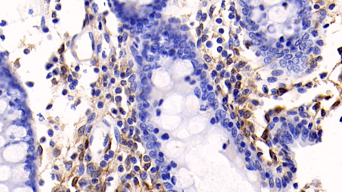 Monoclonal Antibody to Annexin V (ANXA5)