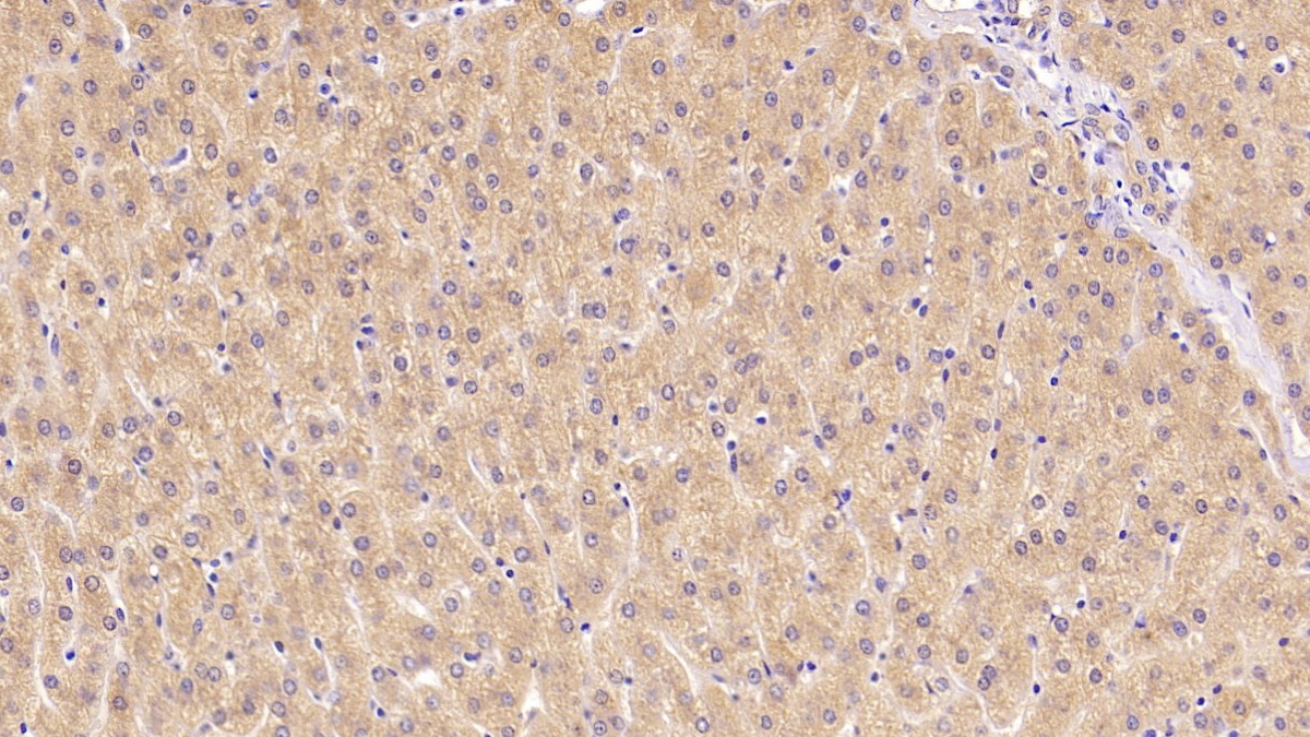 Monoclonal Antibody to Beta-2-Microglobulin (b2M)