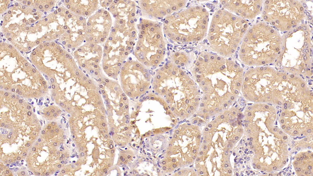 Monoclonal Antibody to Beta-2-Microglobulin (b2M)