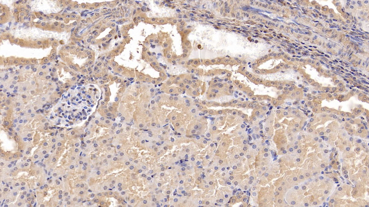 Monoclonal Antibody to Beta-2-Microglobulin (b2M)