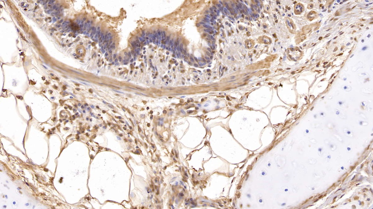 Monoclonal Antibody to Beta-2-Microglobulin (b2M)