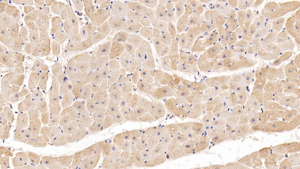 Monoclonal Antibody to Beta-2-Microglobulin (b2M)