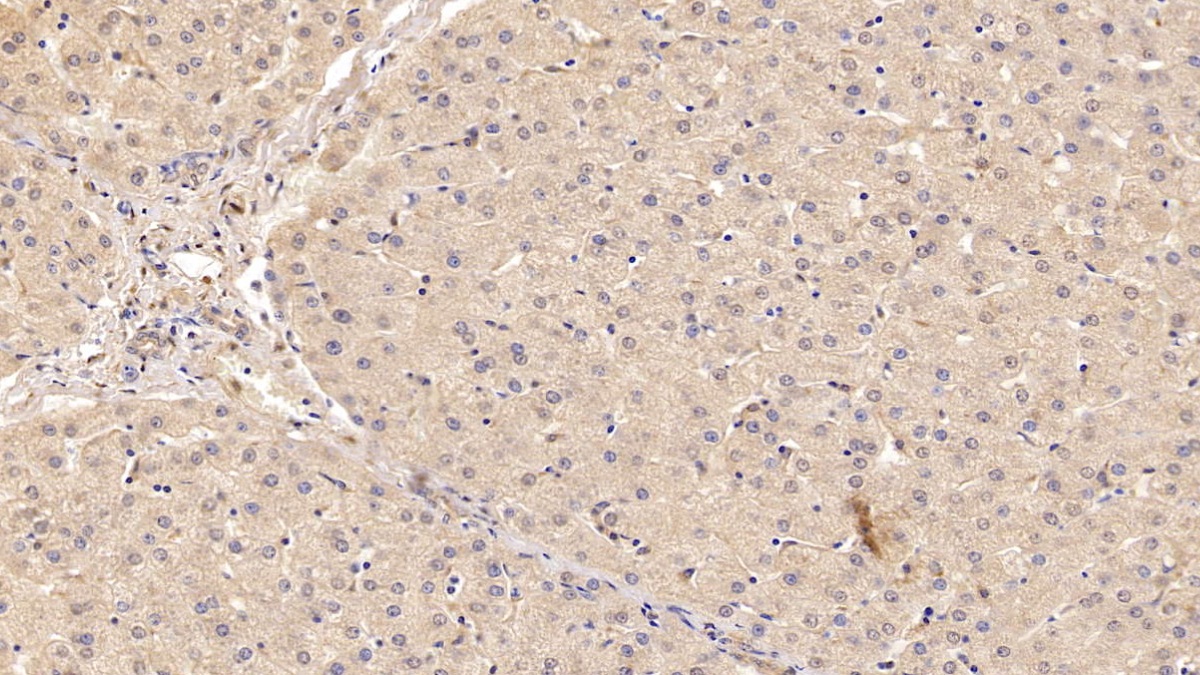 Monoclonal Antibody to Beta-2-Microglobulin (b2M)