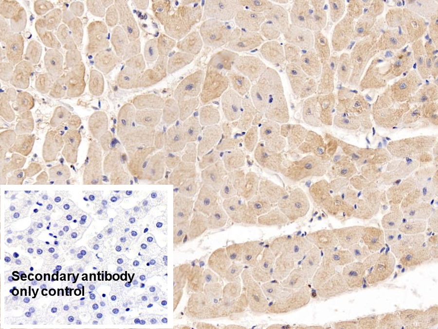 Monoclonal Antibody to Beta-2-Microglobulin (b2M)