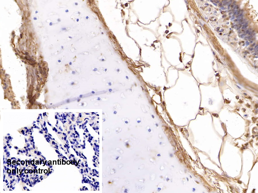 Monoclonal Antibody to Beta-2-Microglobulin (b2M)