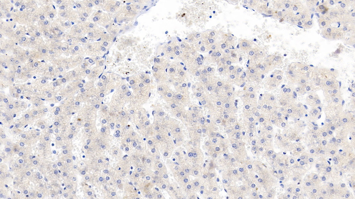 Monoclonal Antibody to Beta-2-Microglobulin (b2M)