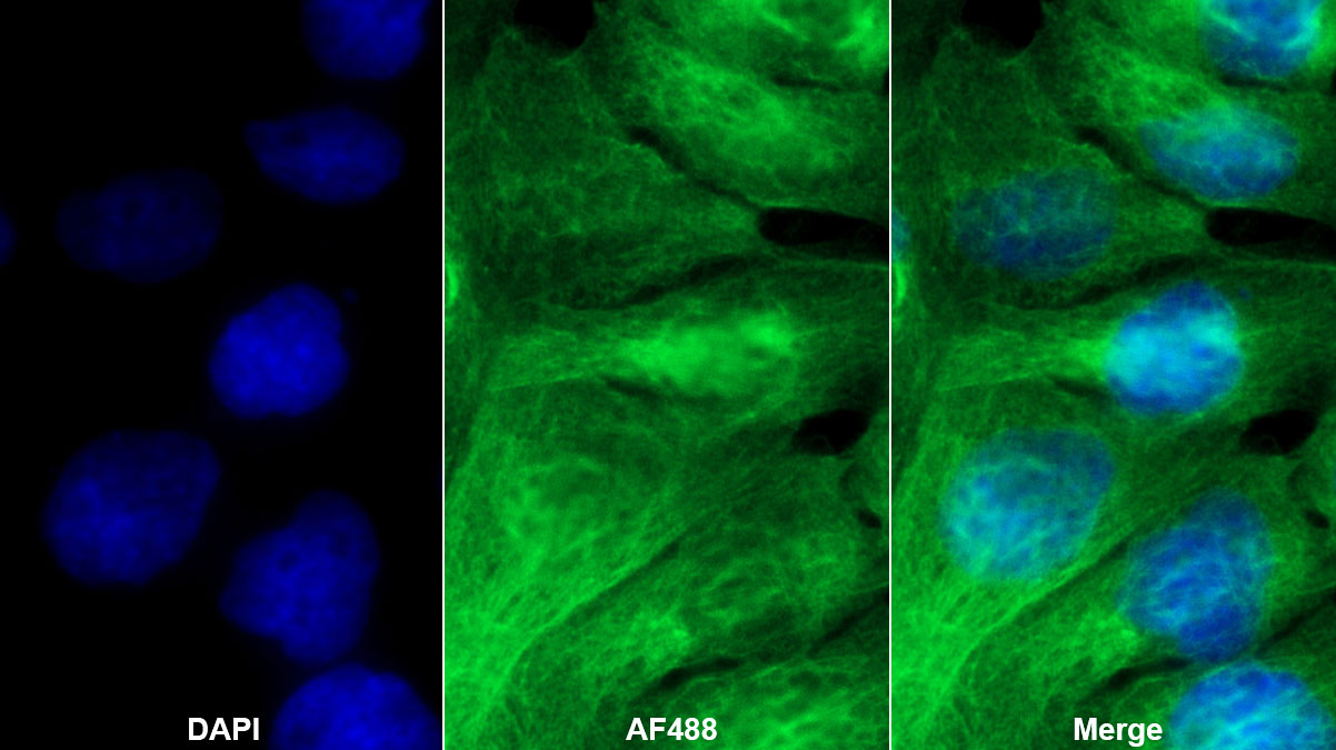 Monoclonal Antibody to Beta-2-Microglobulin (b2M)