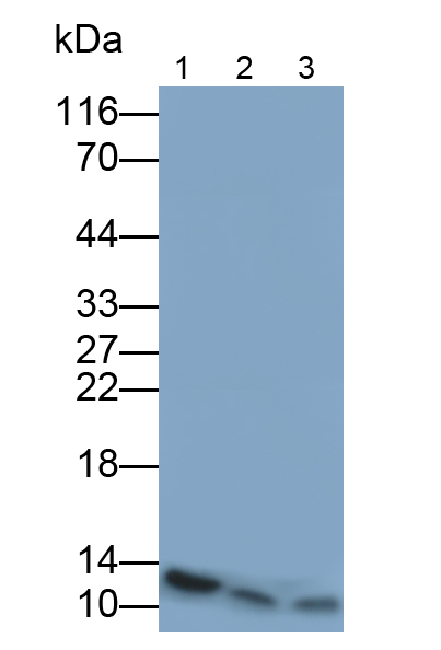 Monoclonal Antibody to Beta-2-Microglobulin (b2M)