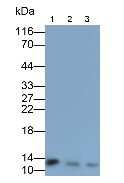 Monoclonal Antibody to Beta-2-Microglobulin (b2M)