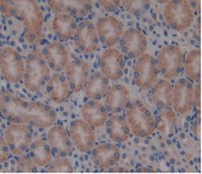 Monoclonal Antibody to Beta-2-Microglobulin (b2M)