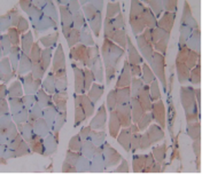 Monoclonal Antibody to Beta-2-Microglobulin (b2M)