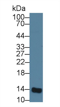 Monoclonal Antibody to Beta-2-Microglobulin (b2M)