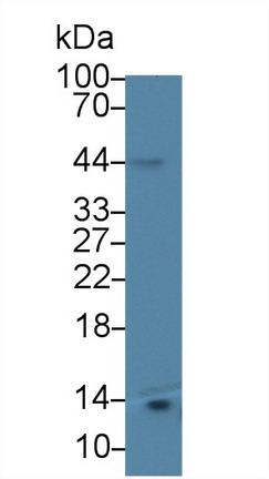 Monoclonal Antibody to Beta-2-Microglobulin (b2M)