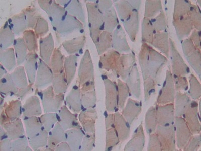 Monoclonal Antibody to Beta-2-Microglobulin (b2M)