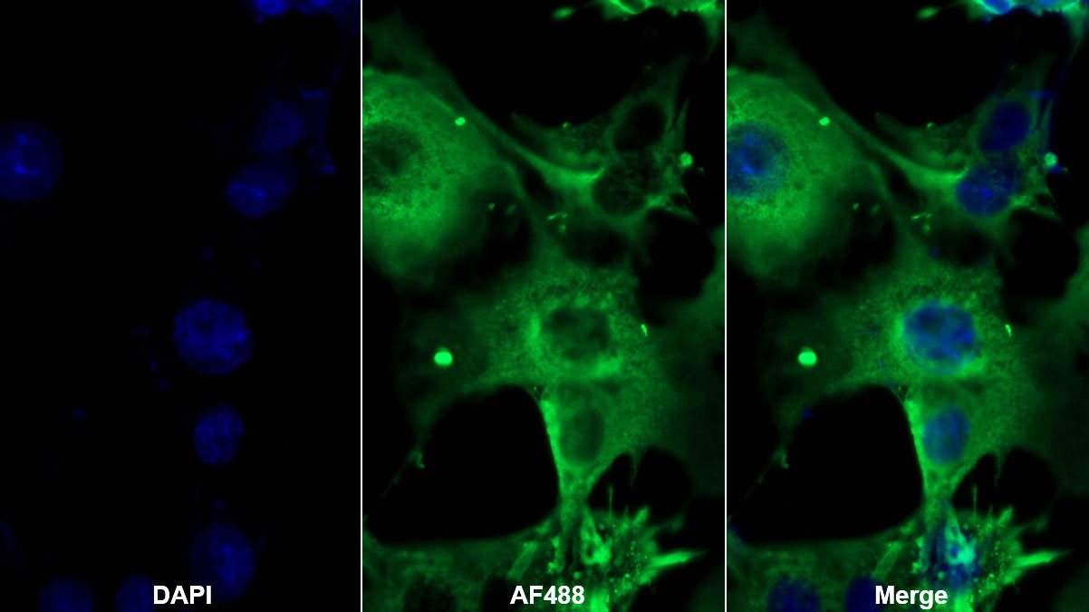 Monoclonal Antibody to Beta-2-Microglobulin (b2M)