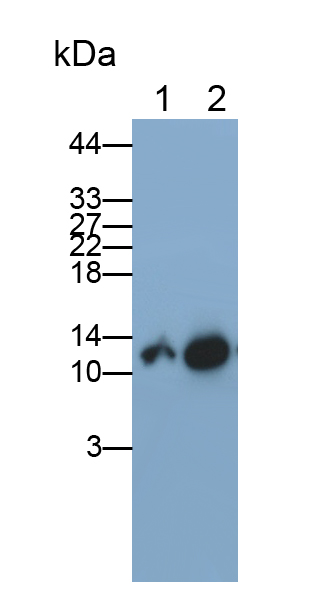 Monoclonal Antibody to Beta-2-Microglobulin (b2M)