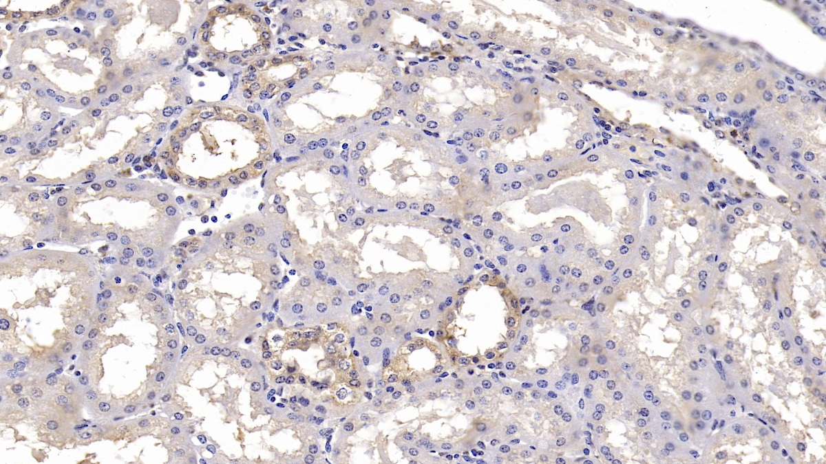 Monoclonal Antibody to Calnexin (CNX)