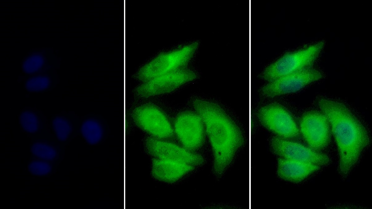 Monoclonal Antibody to Calnexin (CNX)