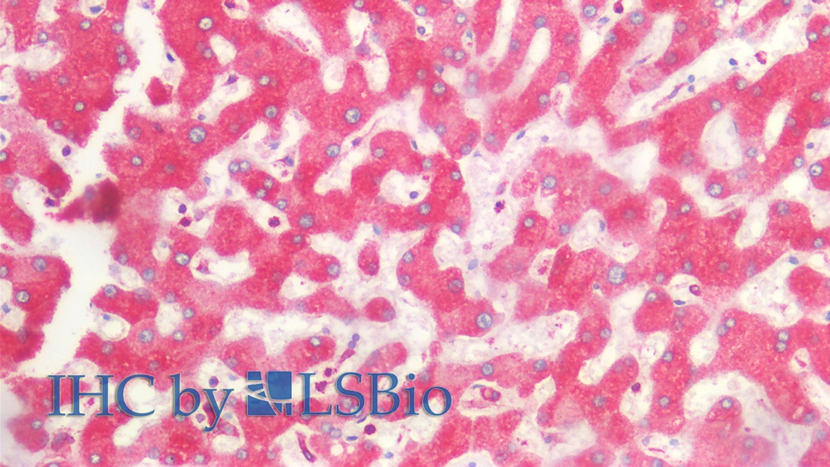 Monoclonal Antibody to Calnexin (CNX)