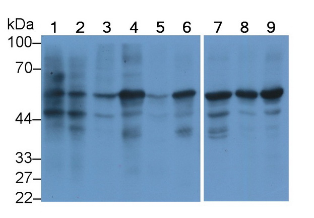 Monoclonal Antibody to Calnexin (CNX)