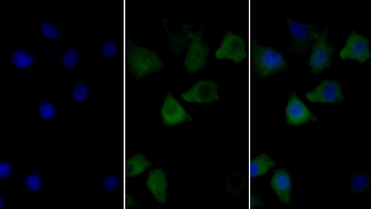 Monoclonal Antibody to Calnexin (CNX)