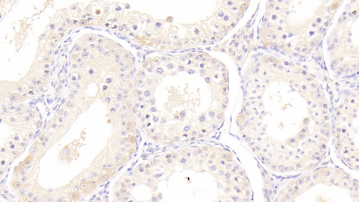 Monoclonal Antibody to Heat Shock 70kDa Protein 1B (HSPA1B)